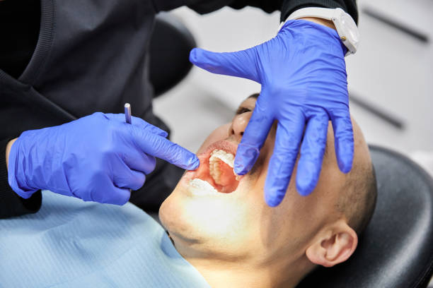 Tooth Infection Emergency Dentist in NY